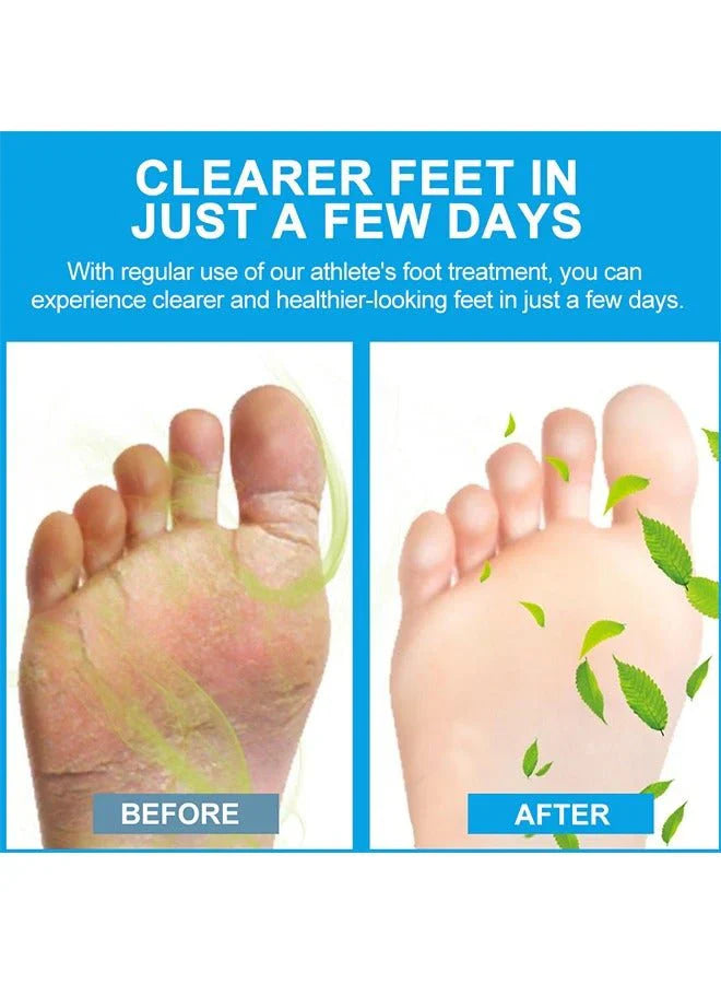 Sumifun – Foot Anti-Bacterial Cream